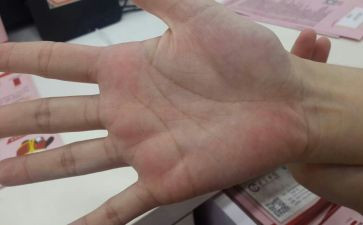 幼儿园手掌画教案6篇